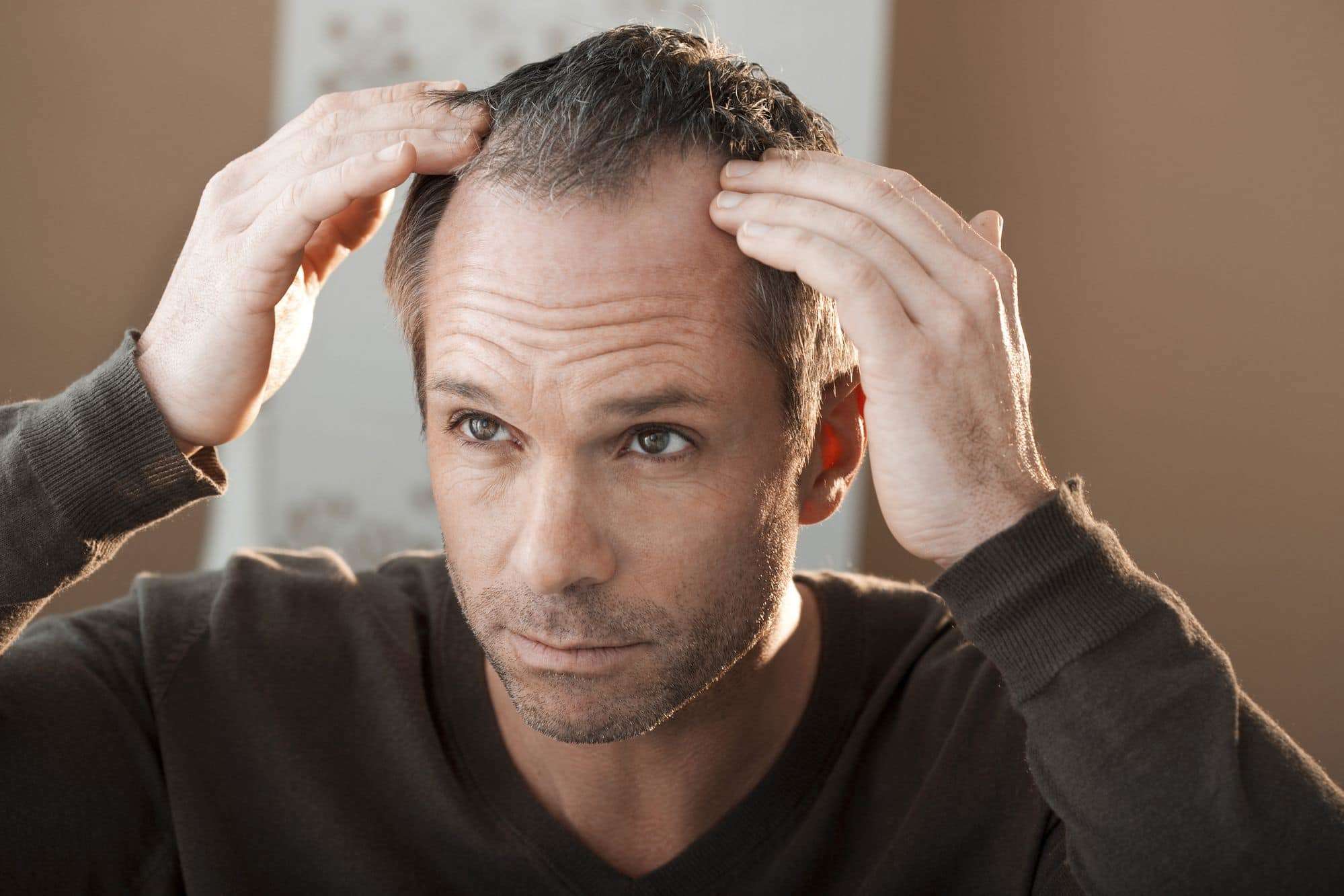 How Much Hair Loss Is Normal? What the Research Actually Says